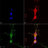 Monoclonal Anti-TRPC7 antibody produced in mouse clone S64A-36, 1&#160;mg/mL, purified immunoglobulin