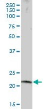 Anti-RNF170 antibody produced in mouse IgG fraction of antiserum, buffered aqueous solution