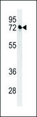 ANTI-KLHL24 (CENTER) antibody produced in rabbit IgG fraction of antiserum, buffered aqueous solution
