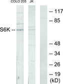 Anti-S6K antibody produced in rabbit affinity isolated antibody