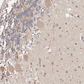 Anti-ADAMTS9 antibody produced in rabbit Prestige Antibodies&#174; Powered by Atlas Antibodies, affinity isolated antibody, buffered aqueous glycerol solution, ab2
