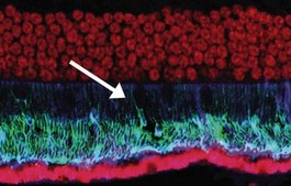Anti-Pigment Epithelium Derived Factor Antibody, clone 10F12.2 clone 10F12.2, Chemicon&#174;, from mouse