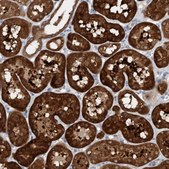Anti-KLHL25 antibody produced in rabbit Prestige Antibodies&#174; Powered by Atlas Antibodies, affinity isolated antibody, buffered aqueous glycerol solution