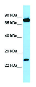 Anti-SNX27 (C-terminal) antibody produced in rabbit affinity isolated antibody