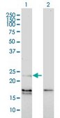 Monoclonal Anti-EDN1 antibody produced in mouse clone 3D6, purified immunoglobulin, buffered aqueous solution