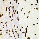 Anti-DiMethyl-Histone H3-K27 antibody produced in rabbit
