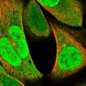 Anti-RNF187 antibody produced in rabbit Prestige Antibodies&#174; Powered by Atlas Antibodies, affinity isolated antibody, buffered aqueous glycerol solution
