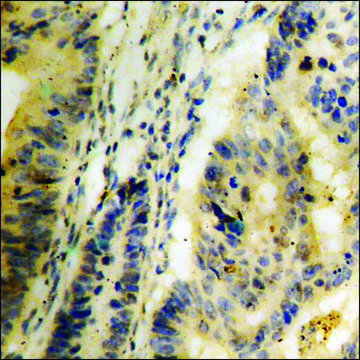 Anti-phospho-Trk C (pTyr516) antibody produced in rabbit affinity isolated antibody
