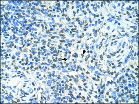 Anti-ZMyND11 (AB1) antibody produced in rabbit IgG fraction of antiserum