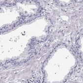 Anti-ACTN2 antibody produced in rabbit Prestige Antibodies&#174; Powered by Atlas Antibodies, affinity isolated antibody, buffered aqueous glycerol solution