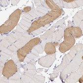 Anti-MYH6 antibody produced in rabbit Prestige Antibodies&#174; Powered by Atlas Antibodies, affinity isolated antibody, buffered aqueous glycerol solution