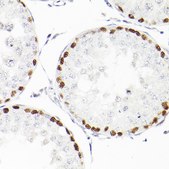 Anti-WT1 Antibody, clone 6L9X6, Rabbit Monoclonal