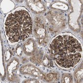 Anti-BST2 antibody produced in rabbit Prestige Antibodies&#174; Powered by Atlas Antibodies, affinity isolated antibody, buffered aqueous glycerol solution