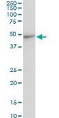 Monoclonal Anti-CMAS antibody produced in mouse clone 2E1, purified immunoglobulin, buffered aqueous solution