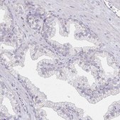 Anti-ATP1A3 antibody produced in rabbit Prestige Antibodies&#174; Powered by Atlas Antibodies, affinity isolated antibody, buffered aqueous glycerol solution
