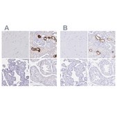 Anti-UMOD antibody produced in rabbit Prestige Antibodies&#174; Powered by Atlas Antibodies, affinity isolated antibody, buffered aqueous glycerol solution