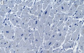 Anti-OXCT1 Antibody, clone 1B11 ZooMAb&#174; Rabbit Monoclonal recombinant, expressed in HEK 293 cells