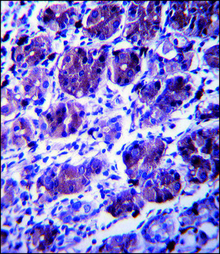 ANTI-CCDC22 (C-TERM) antibody produced in rabbit IgG fraction of antiserum, buffered aqueous solution