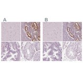 Anti-PAEP antibody produced in rabbit Prestige Antibodies&#174; Powered by Atlas Antibodies, affinity isolated antibody, buffered aqueous glycerol solution