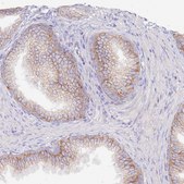 Anti-FLVCR1 antibody produced in rabbit Prestige Antibodies&#174; Powered by Atlas Antibodies, affinity isolated antibody, buffered aqueous glycerol solution