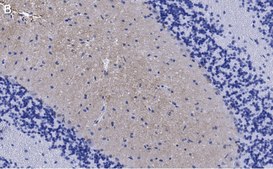 Anti-GluR1 Antibody, clone 1C11, ZooMAb&#174; Rabbit Monoclonal recombinant, expressed in HEK 293 cells