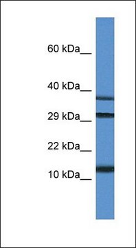 Anti-UBL3 antibody produced in rabbit affinity isolated antibody
