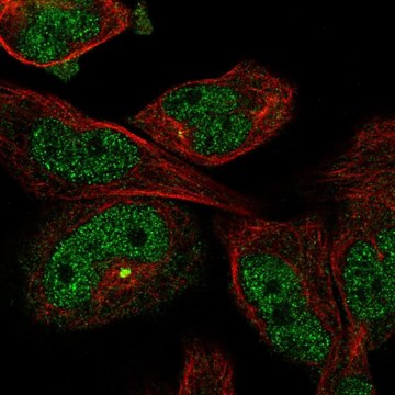 Anti-MYO18B antibody produced in rabbit affinity isolated antibody, buffered aqueous glycerol solution