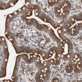 Anti-FAAH antibody produced in rabbit Prestige Antibodies&#174; Powered by Atlas Antibodies, affinity isolated antibody, buffered aqueous glycerol solution