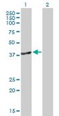 Anti-DNMT3L antibody produced in mouse IgG fraction of antiserum, buffered aqueous solution