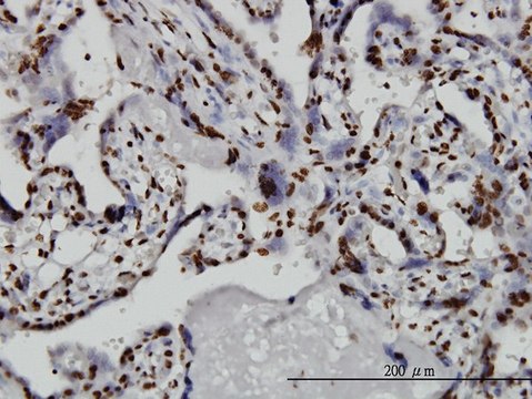 ANTI-TAF11 antibody produced in mouse clone 2G9, purified immunoglobulin, buffered aqueous solution