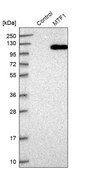 Anti-MTF1 antibody produced in rabbit Prestige Antibodies&#174; Powered by Atlas Antibodies, affinity isolated antibody, buffered aqueous glycerol solution, ab2
