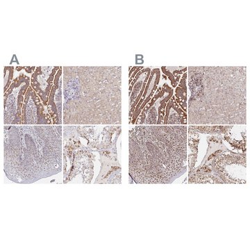 Anti-MAVS antibody produced in rabbit Prestige Antibodies&#174; Powered by Atlas Antibodies, affinity isolated antibody, buffered aqueous glycerol solution