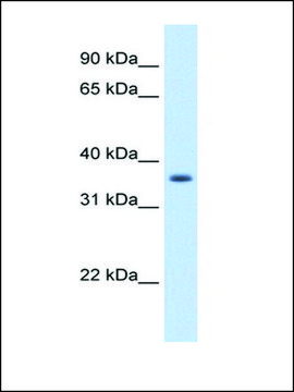 Anti-AKR1B10 antibody produced in rabbit IgG fraction of antiserum