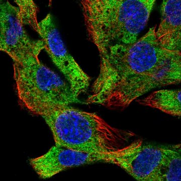 Anti-Eif2B4 Antibody Produced In Rabbit Prestige Antibodies&#174; Powered by Atlas Antibodies, affinity isolated antibody, buffered aqueous glycerol solution