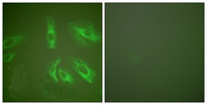 Anti-Gastrin antibody produced in rabbit affinity isolated antibody