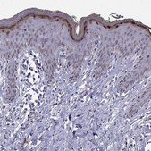 Anti-LOR Prestige Antibodies&#174; Powered by Atlas Antibodies, affinity isolated antibody
