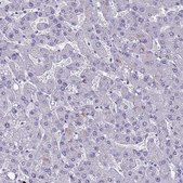 Anti-MUC13 antibody produced in rabbit Prestige Antibodies&#174; Powered by Atlas Antibodies, affinity isolated antibody, buffered aqueous glycerol solution