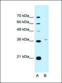 Anti-PEX3 antibody produced in rabbit IgG fraction of antiserum