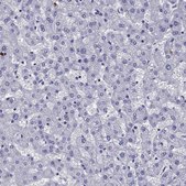 Anti-OLFM4 Prestige Antibodies&#174; Powered by Atlas Antibodies, affinity isolated antibody