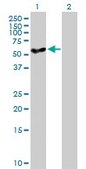 Anti-CYP27A1 antibody produced in mouse IgG fraction of antiserum, buffered aqueous solution