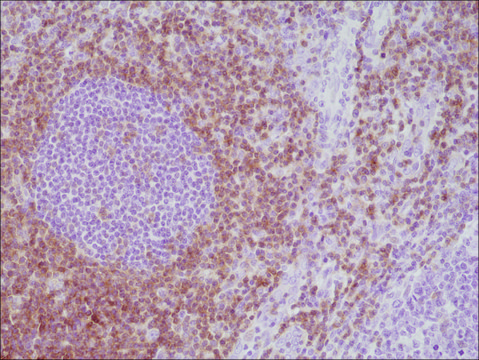 Anti-CD5 antibody, Rabbit monoclonal recombinant, expressed in HEK 293 cells, clone RM354, purified immunoglobulin