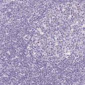 Anti-SLC13A1 antibody produced in rabbit Prestige Antibodies&#174; Powered by Atlas Antibodies, affinity isolated antibody, buffered aqueous glycerol solution
