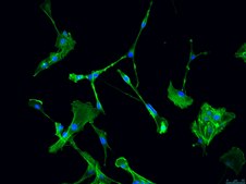 CNS-1 Rat Glioma Cell Line