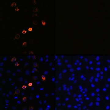 Monoclonal Anti-2019-nCoV Spike antibody produced in Rabbit