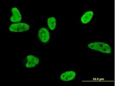 Monoclonal Anti-BAX antibody produced in mouse clone 1F5-1B7, purified immunoglobulin, buffered aqueous solution