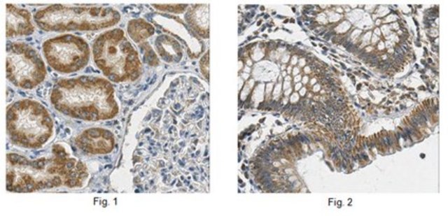 Anti-Prohibitin Antibody from rabbit, purified by affinity chromatography