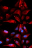 Anti-S100A11 antibody produced in rabbit