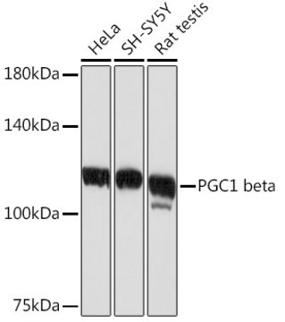 Anti-PGC1 beta Antibody, clone 3K4V1, Rabbit Monoclonal