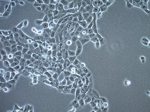 UM-SCC-1 Squamous Carcinoma Cell Line UM-SCC-1 is a unique human head and neck squamous cell carcinoma (HNSCC) cell line isolated from a tumor located on the floor of the mouth of a male patient and is a suitable in vitro model of H&amp;N carcinoma studies.