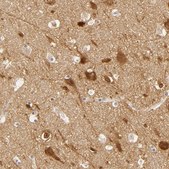 Anti-DLG3 antibody produced in rabbit Prestige Antibodies&#174; Powered by Atlas Antibodies, affinity isolated antibody, buffered aqueous glycerol solution
